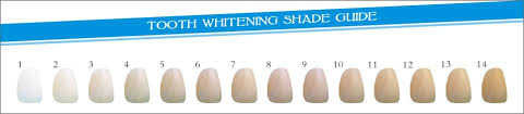 teeth-whitening-shade-and-discoloration-whitening-guide-scale