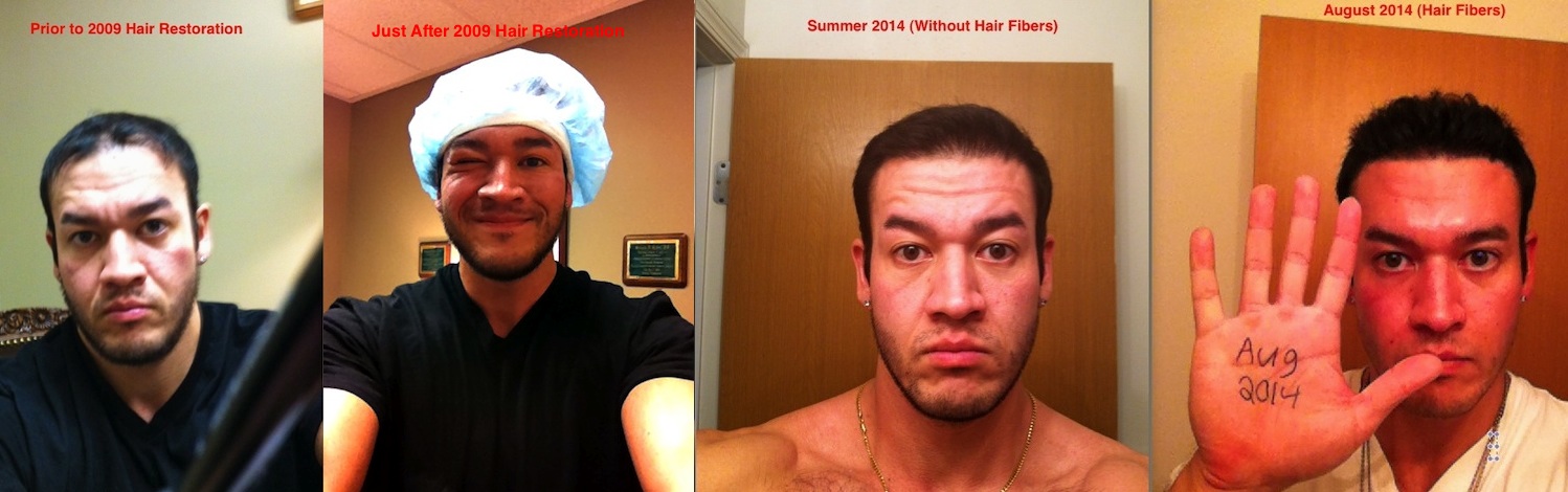 Chris Hair Restoration