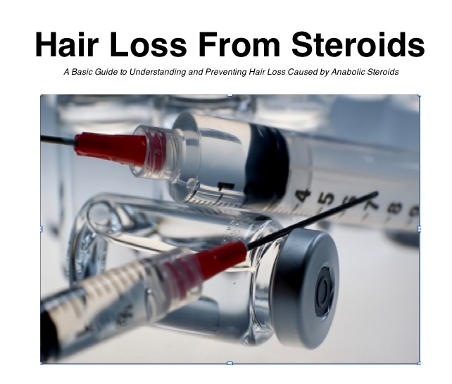 Hair Loss From Steroids Image
