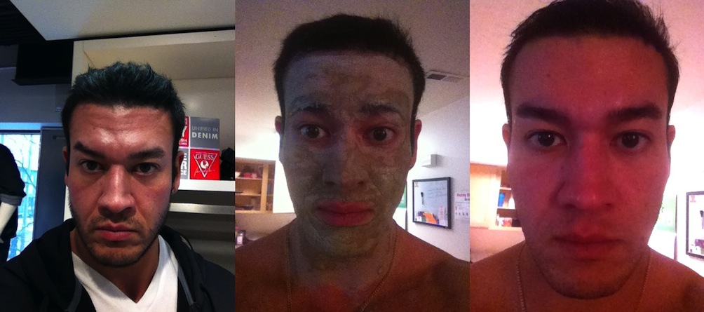 before during after facial