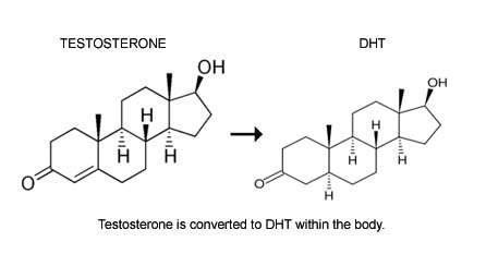 TESTOSTERONE-DHT