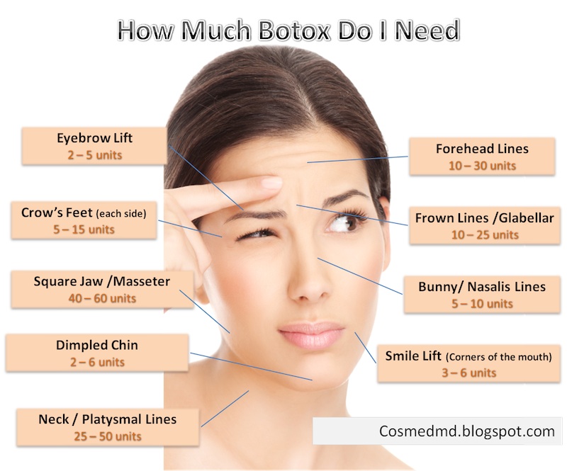 How Much Botox Do I Need