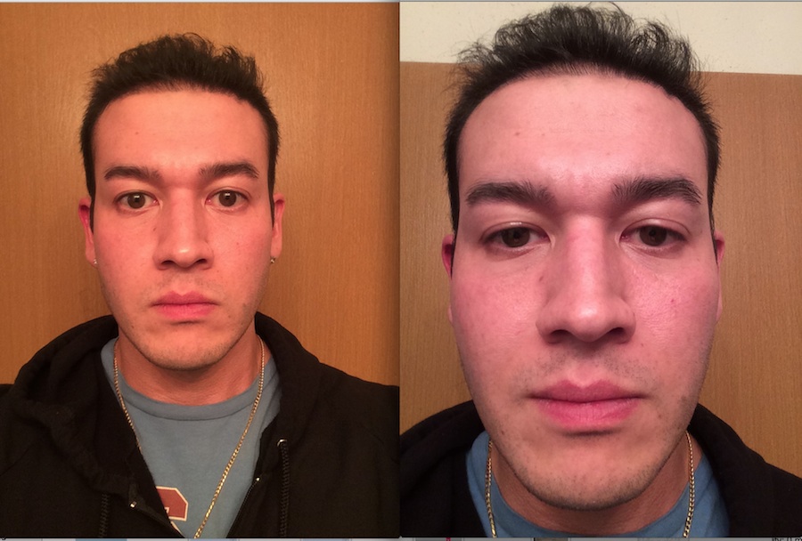 Shaved After 2015